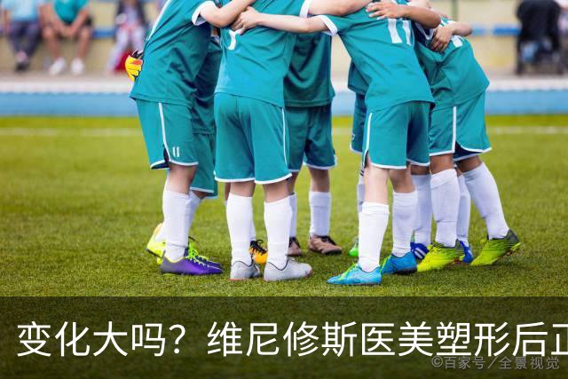 变化大吗？维尼修斯医美塑形后正脸视频，面带微笑祝朋友生日快乐